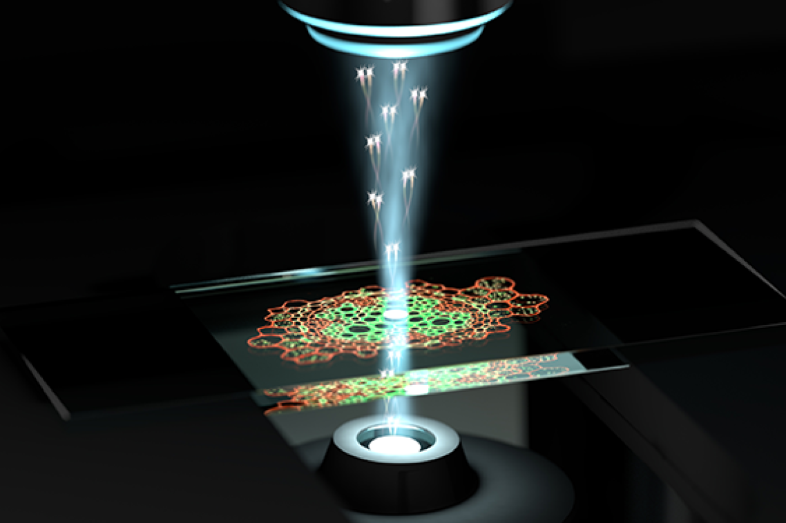 Artist's impression of UQ's new quantum microscope in action