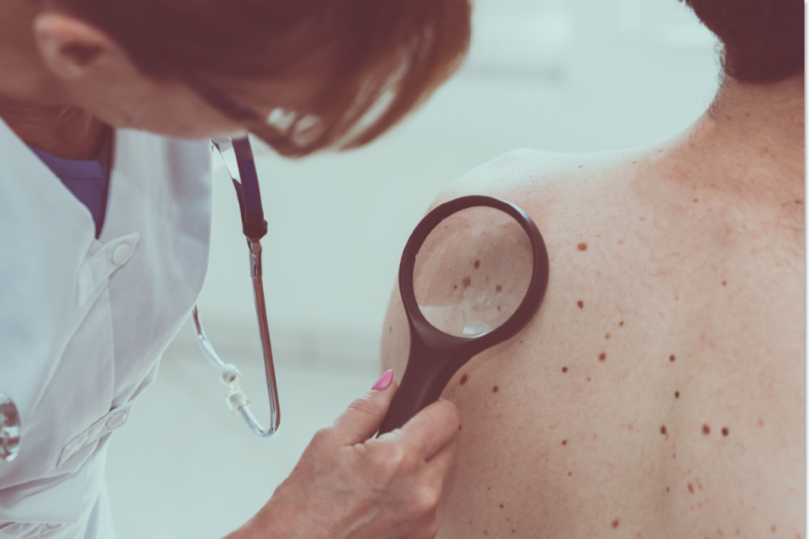 What is the economic impact of teledermoscopy as a viable method of skin cancer triage? 
