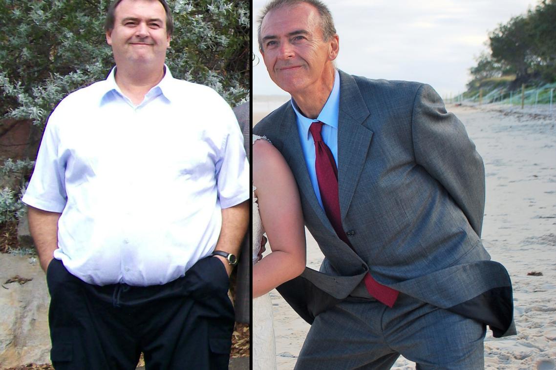 Terry Starbuck before and after
