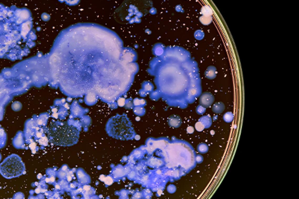 Macro photo of colourful bacteria in a petri dish.
