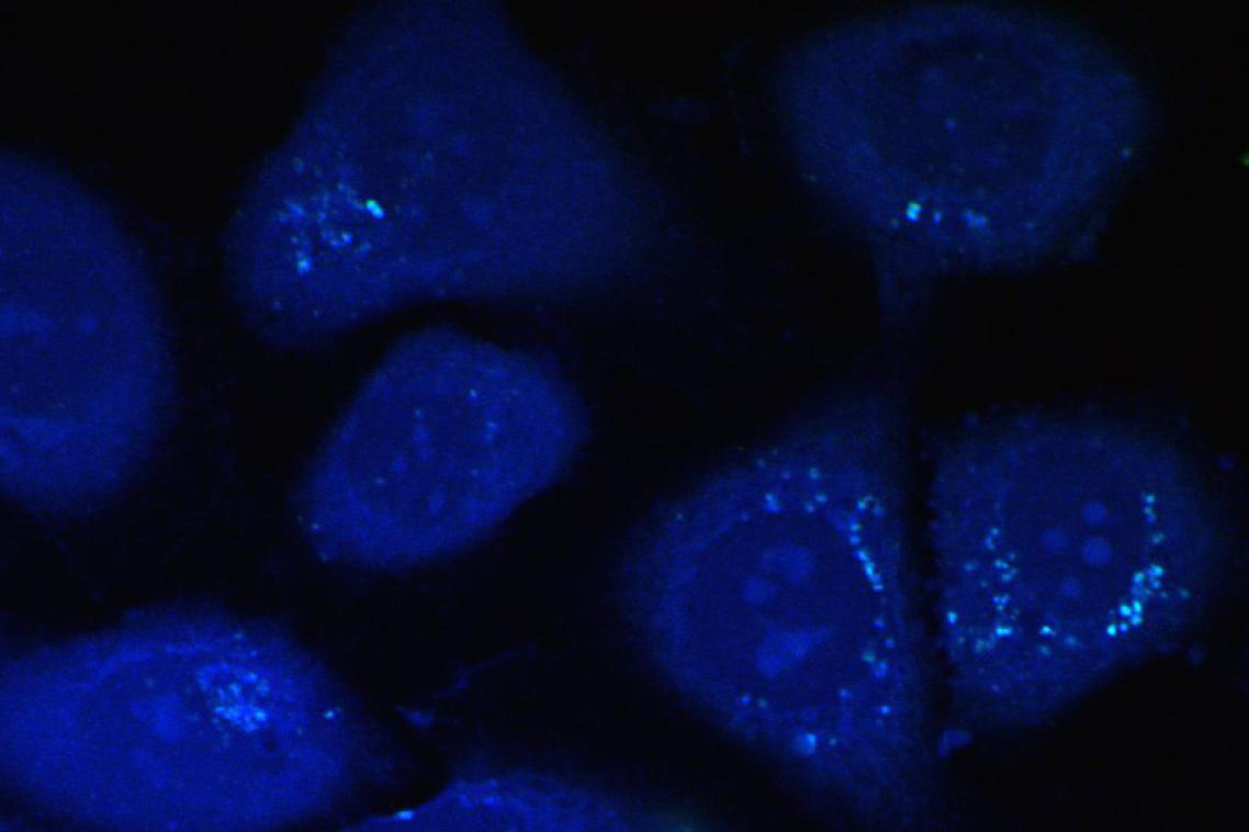 Cholesterol in cells
