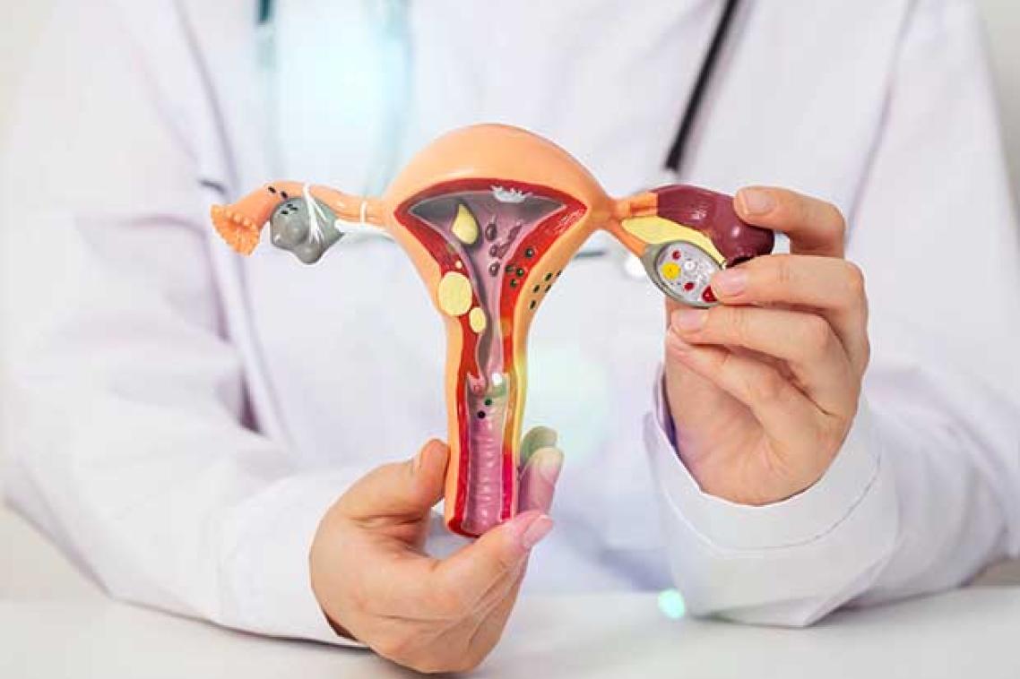 doctor holding 3D model of uterus