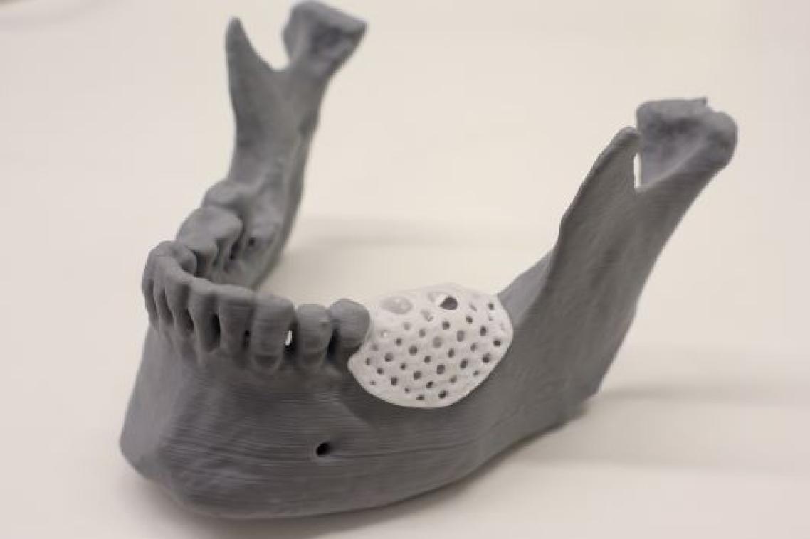 A model jaw covered by a small latticed 3d-printed cover 