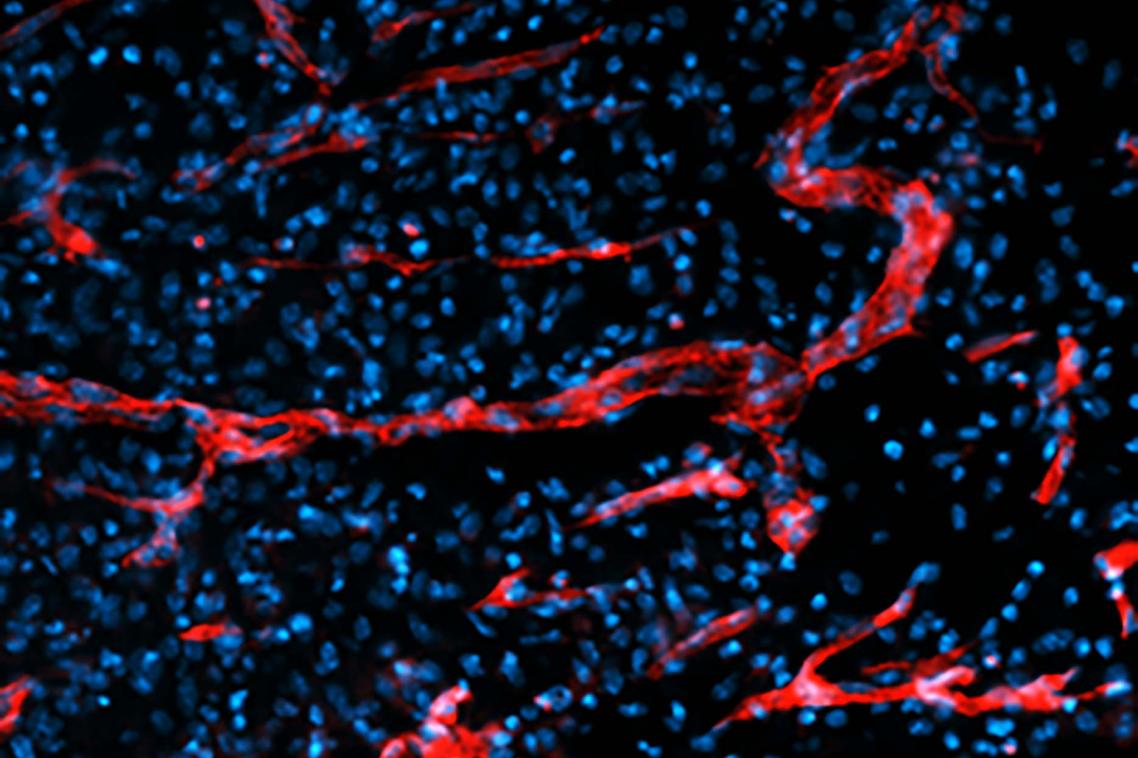 A blood vessel within a wound