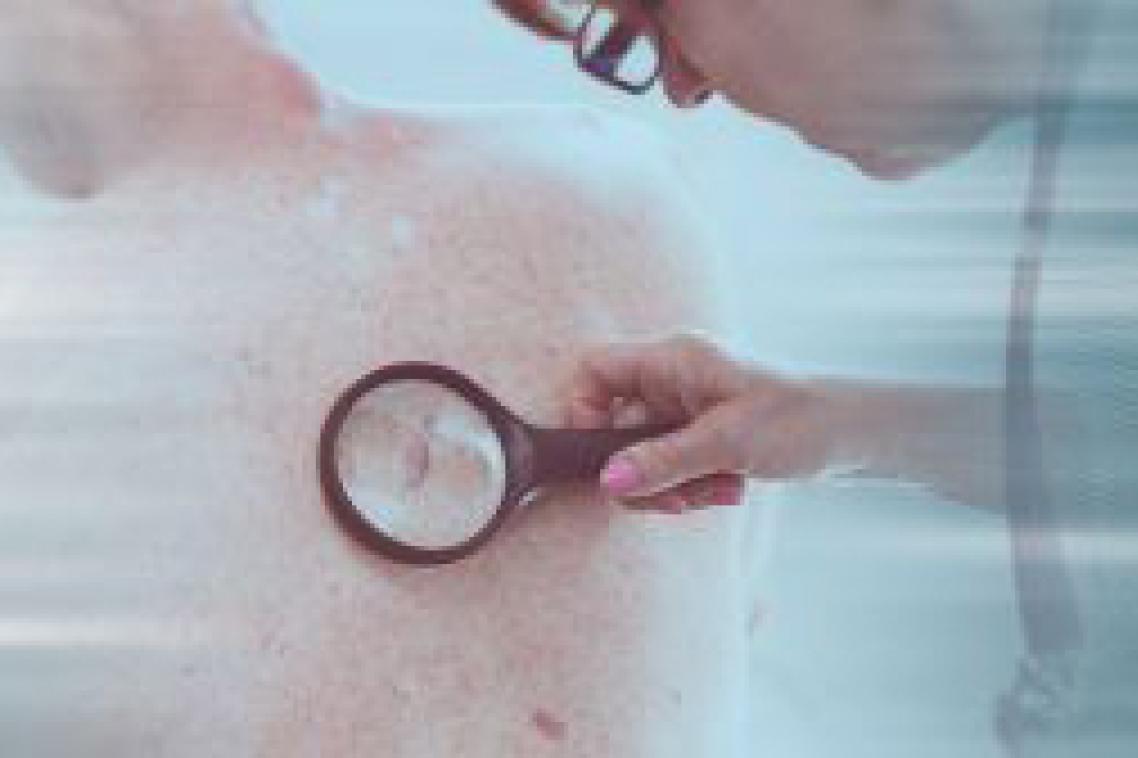 Magnifying glass over skin cancer.