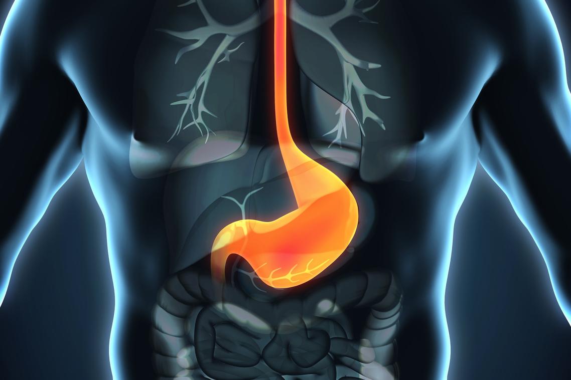 The incidence of oesophagael cancer is increasing, particularly among obese men with reflux (heartburn) and a history of smoking.