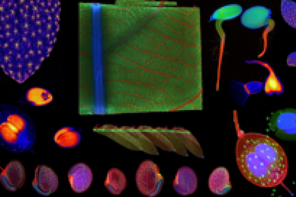 Collage of various synchrotron X-ray fluorescence microscopy images of hyperaccumulator plants. The colours denote different elements. This data was acquired on the X-ray Fluorescence Microscopy beamline of the Australian Synchrotron (part of ANSTO), Victoria, Australia.