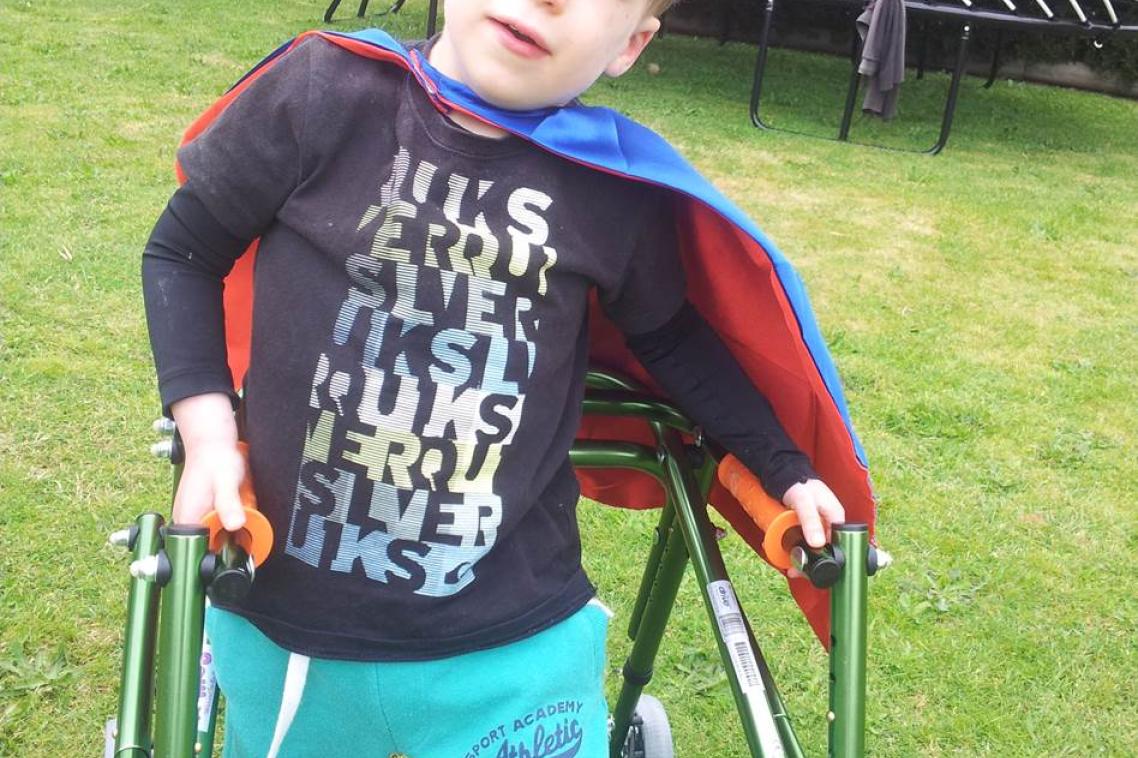 Ashton “Little Superman” Hancock, has hypoplasia of the corpus callosum, resulting in epilepsy and hearing impairment