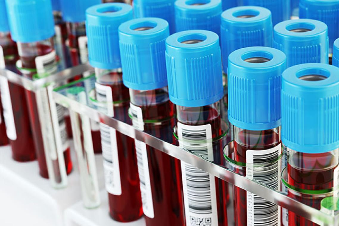 Medical vials of blood