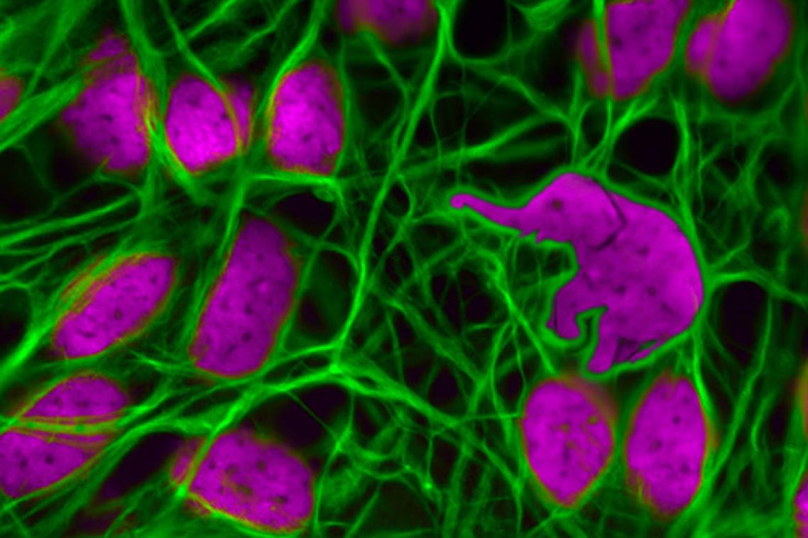 Pink cells