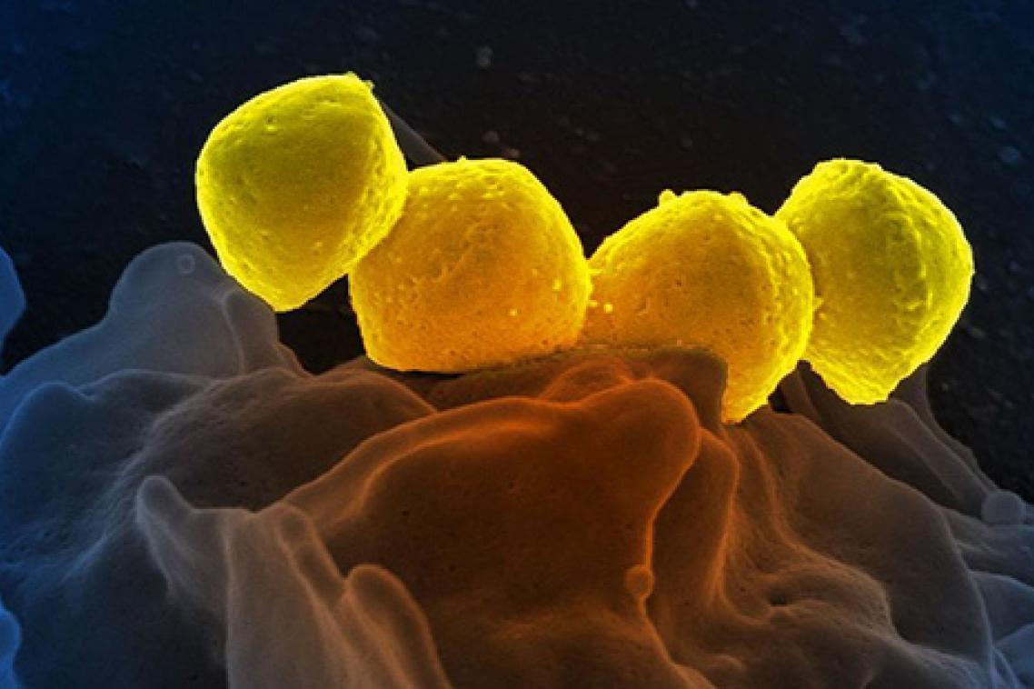 Scanning electron micrograph of Group A Streptococcus bacteria on primary human neutrophil. Credit: NIAID